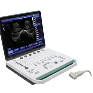 Laptop Black and White Ultrasound Machine / Portable Ultrasound Scanner / Ultrasound Scanning Machine